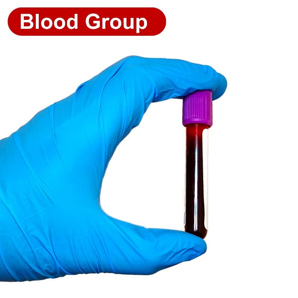 blood-group-test-sti-test-london