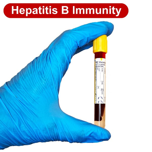 Hepatitis B Immunity Blood Test – STI Test London