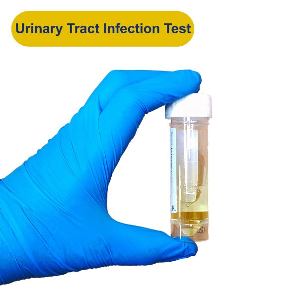Urinary Tract Infections Test