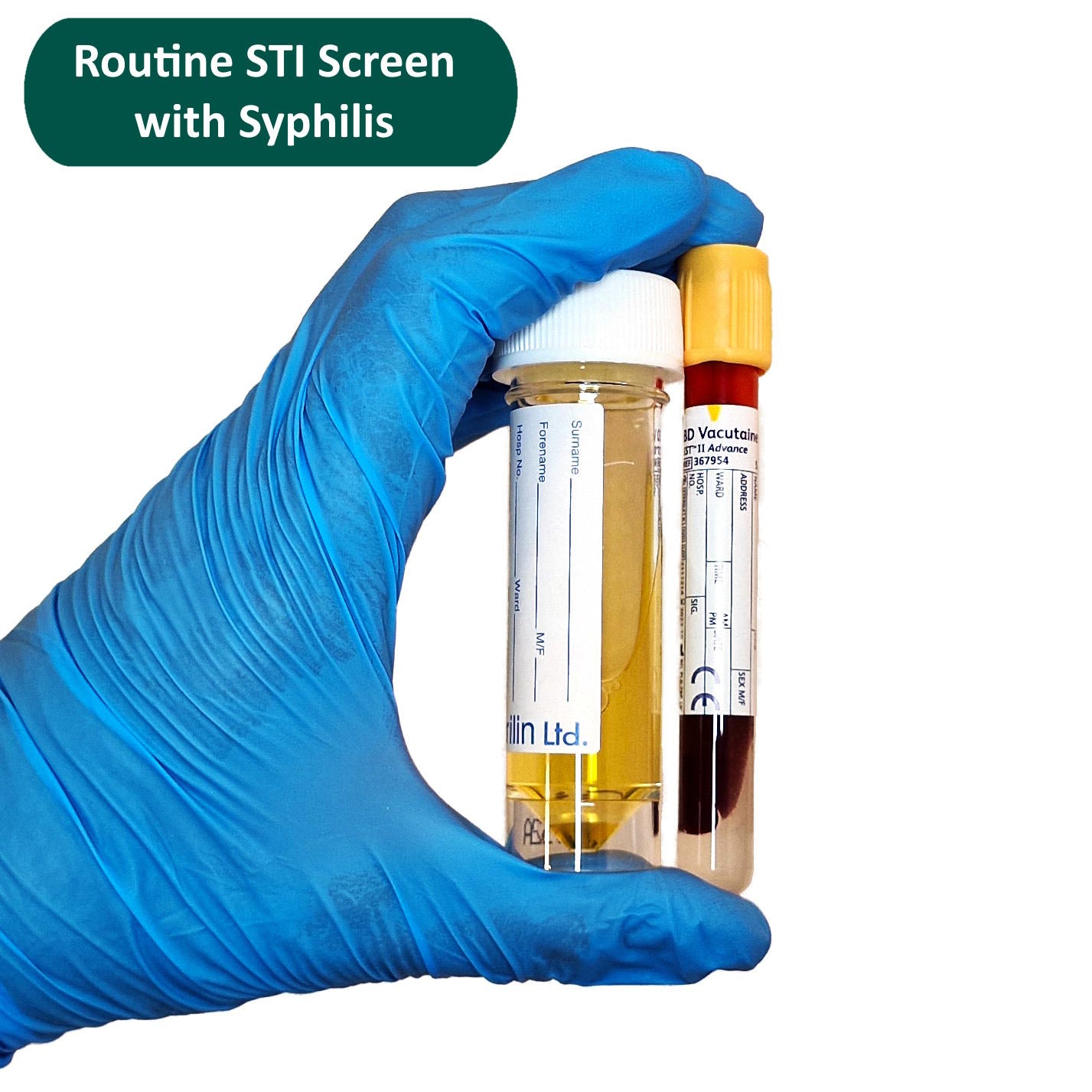 Routine STI Screen with Syphilis