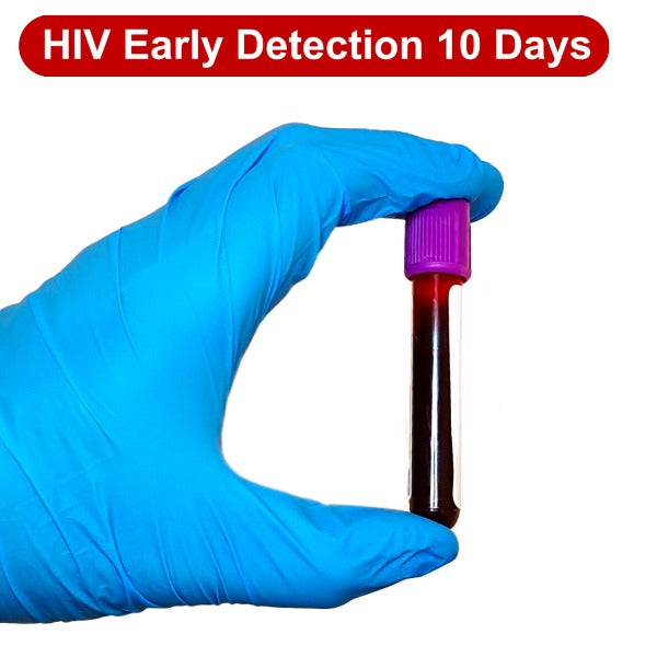 the-new-humanitarian-rapid-hiv-tests-not-infallible